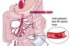 мезентериальный-тромбоз